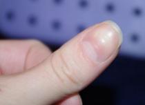 Hvordan trimmes neglebåndene korrekt?
